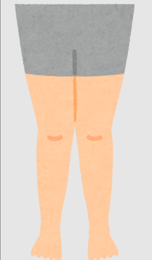 X脚のイラスト